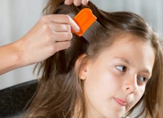 Home Remedies for Lice Treatment Simple and Effective