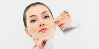 Best Homemade Acne Treatment