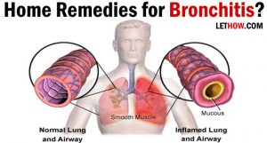 Home Remedies for Bronchitis Treatment