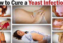 How to Cure a Yeast Infection