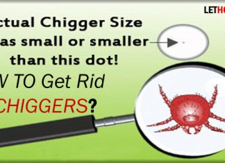 How to Get Rid of Chiggers