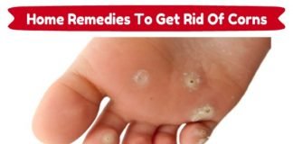 How to Get Rid of Corns