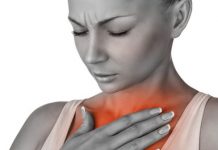 How to Get Rid of Heartburn