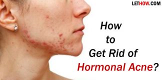 How to Get Rid of Hormonal Acne