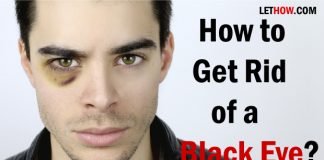 How to Get Rid of a Black Eye