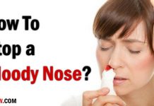 How to Stop a Bloody Nose