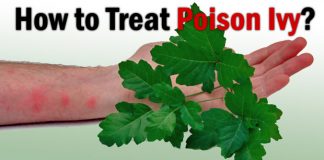 How to Treat Poison Ivy