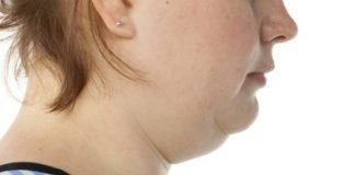 How to get rid of double chin