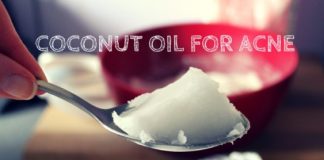 how to use coconut oil for acne
