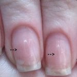 how to remove acrylic nails