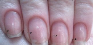 how to remove acrylic nails
