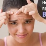 how to get rid of a boil naturally