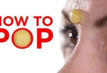 how to pop a pimple