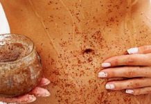 How to remove stretch marks naturally and fast