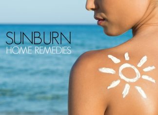 Home Remedies for Sunburn