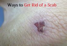 get rid of a scab