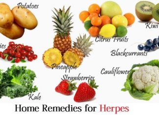 home remedies for herpes