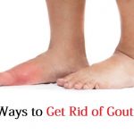 get rid of gout